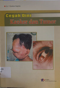 Image of Cegah dini kanker dan tumor