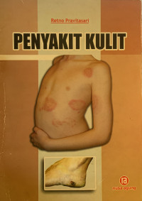Image of Penyakit kulit